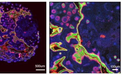 Two brightly coloured microscopic slides, side by side showing blobs and lines. 